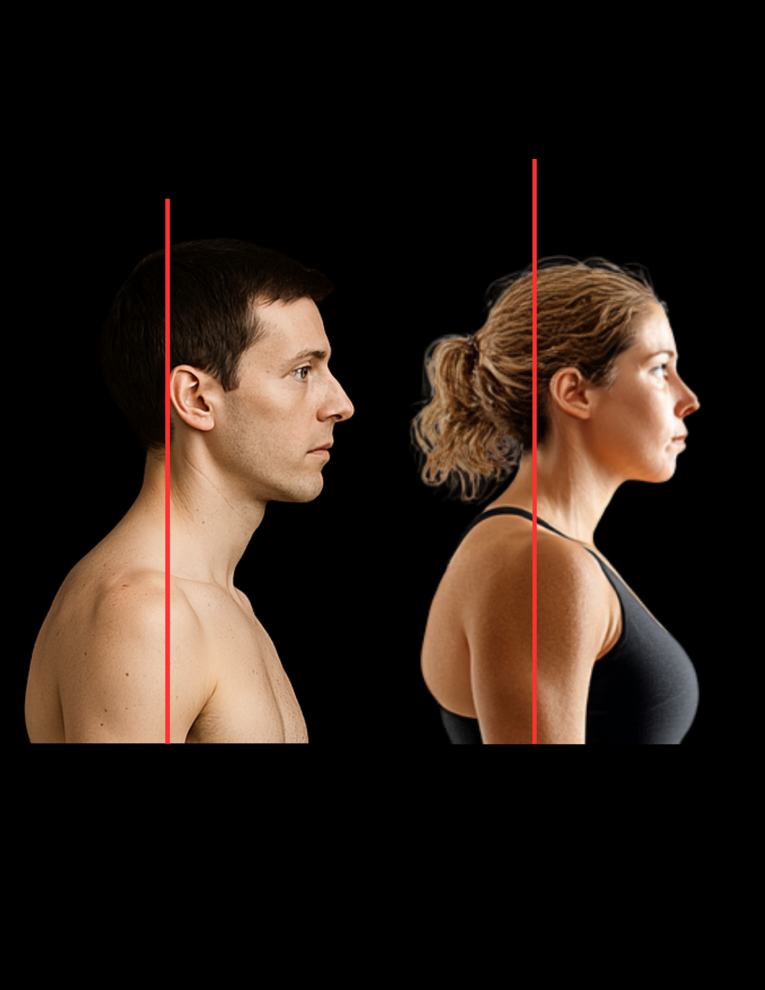 Ears slightly forward of shoulders