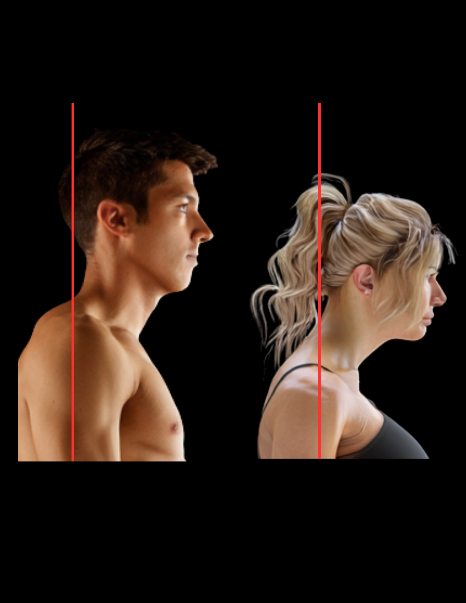 Ears way forward of shoulders